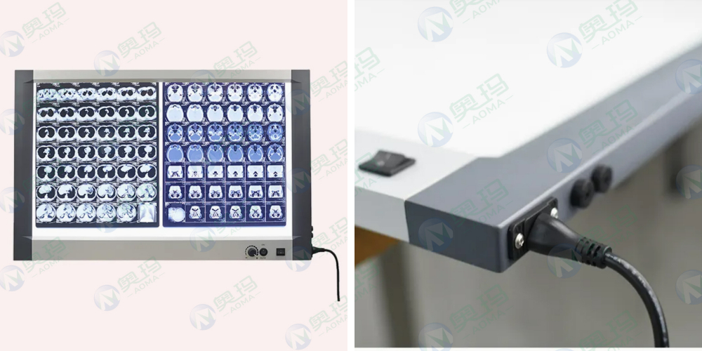 Рентгеновский негатоскоп