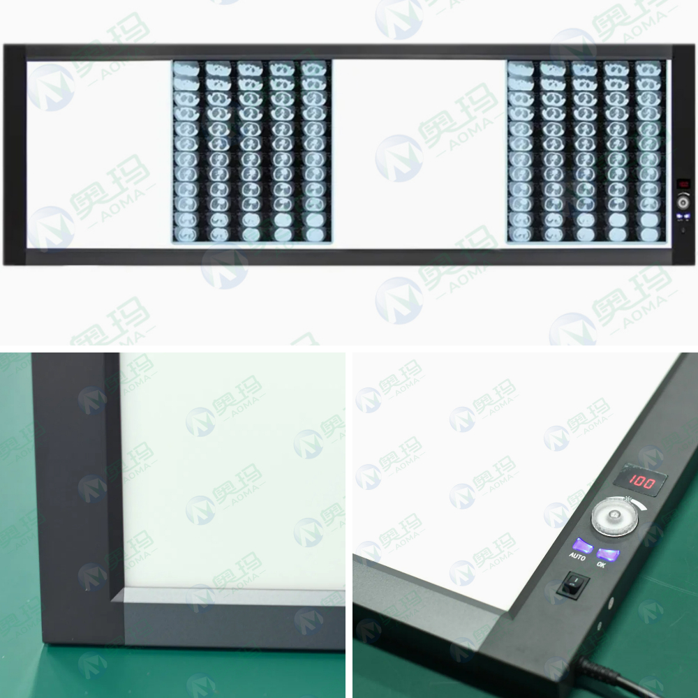 Цифровой просмотрщик рентгеновских снимков