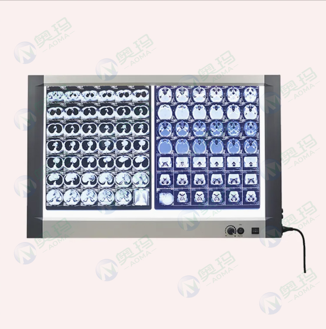 Рентгеновский негатоскоп