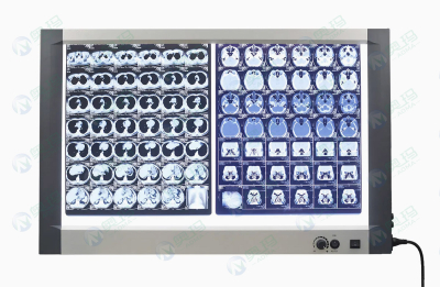 Рентгеновский просмотрщик