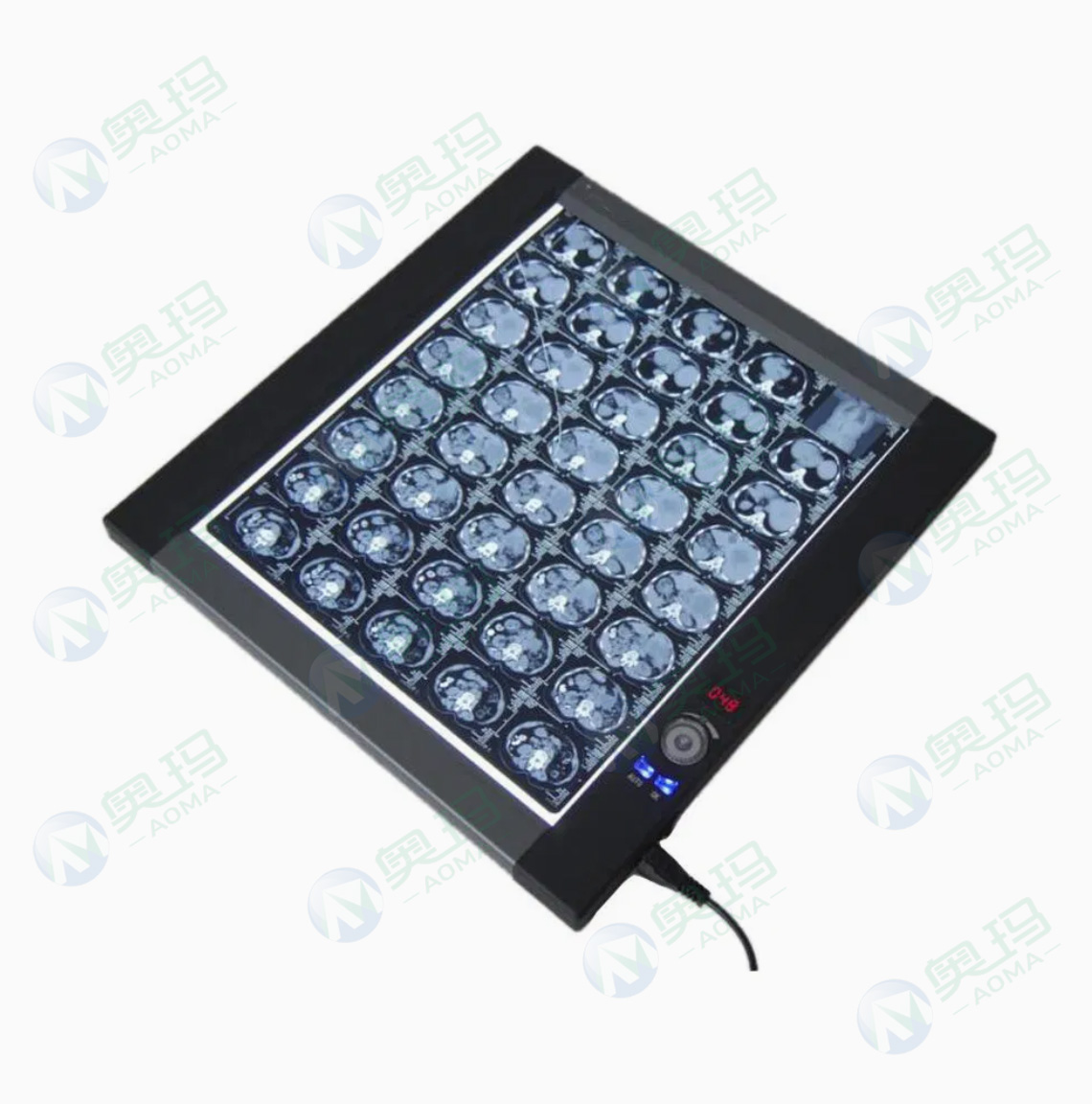 Цифровой просмотрщик рентгеновских снимков